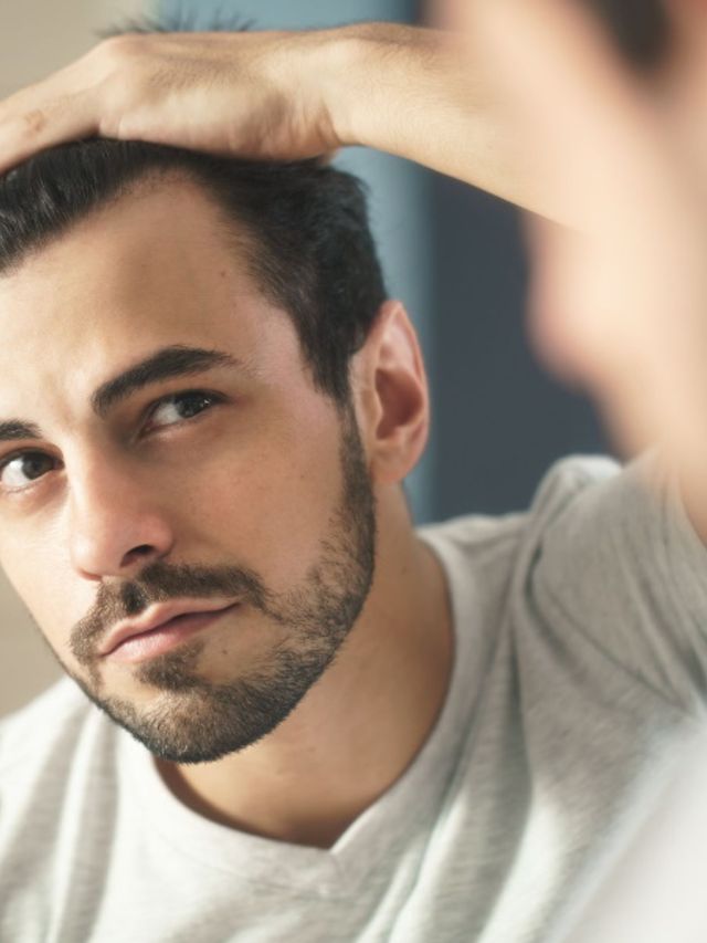 15+ Best Hair Loss Treatments for Men to Beat the Bald Spot | Man of Many