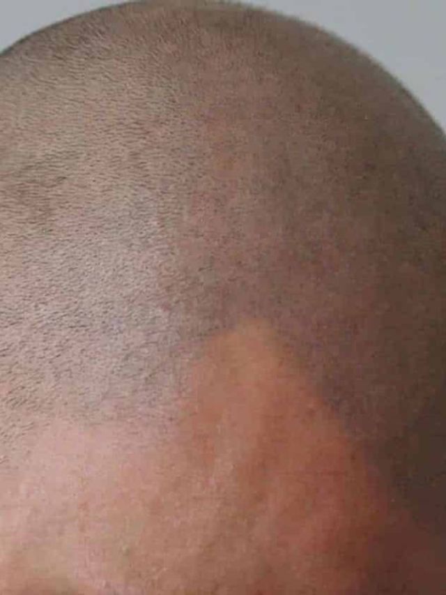 A Guide to Hairline Tattoos | Man of Many